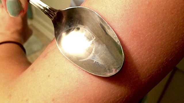 Use A Hot Spoon To Relieve Itchy Insect Bites