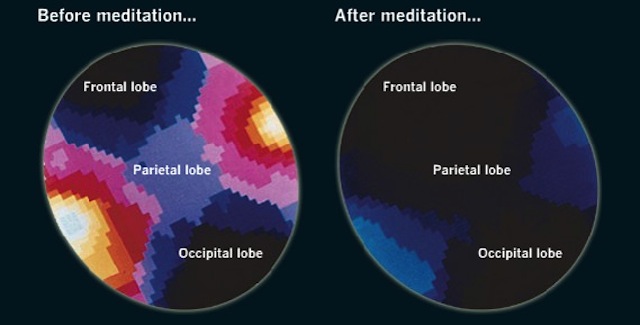 What Happens To The Brain When You Meditate (And How It Benefits You)