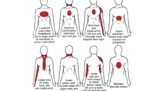 Know The Warning Signs Of A Heart Attack