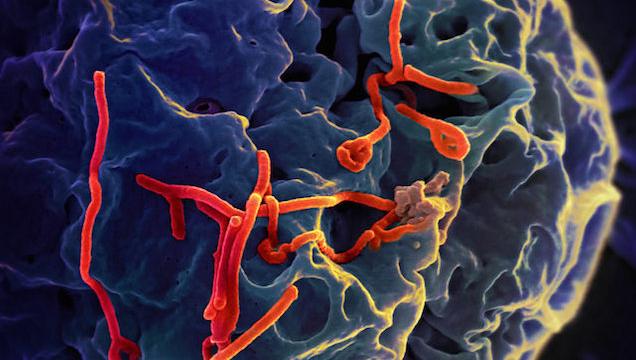 What You Really Need To Know About Ebola