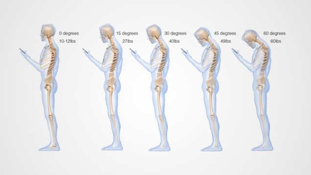 This Is What Looking Down At Your Mobile Phone Does To Your Spine