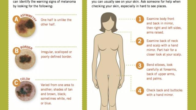 9 Sneaky Warning Signs of Melanoma You Might Miss
