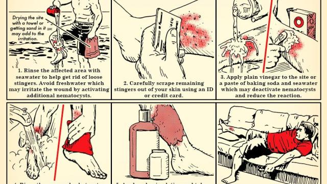 How To Treat A Jellyfish Sting [Infographic]
