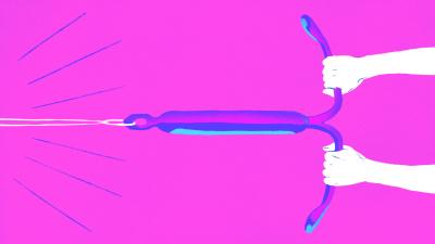 Don’t Dismiss IUDs When Choosing Birth Control