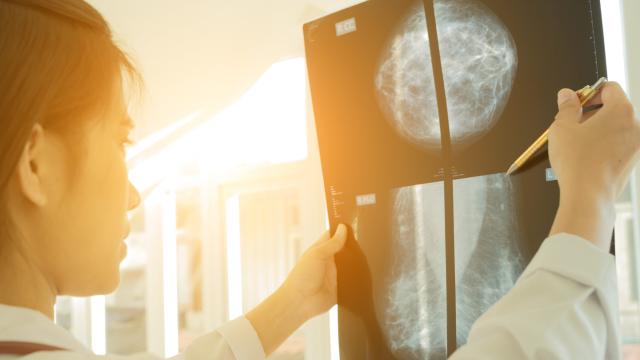 What Can You Expect During Your First Mammogram? And Other Questions, Answered