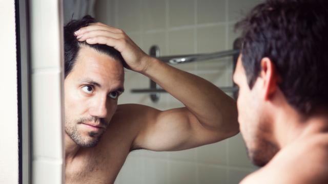7 Common Causes for Hair Loss and How to Prevent It