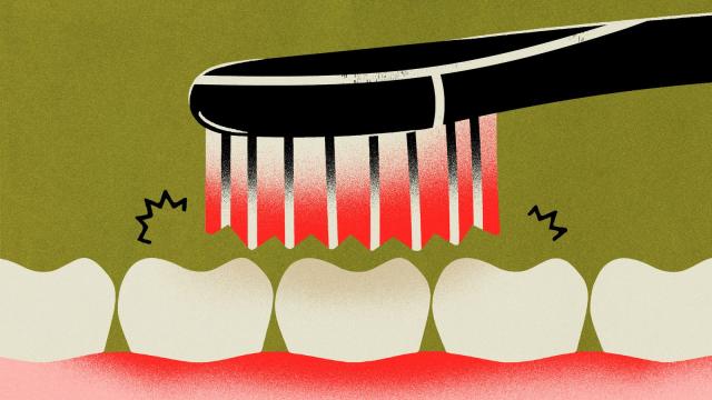 How to Know If You’re Brushing Your Teeth Too Hard