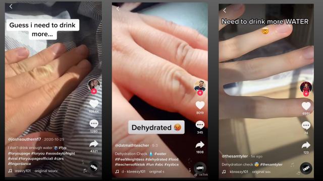 TikTok’s ‘Dehydration Check’ Is Silly and Useless