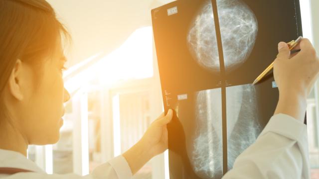 Why It Matters If You Have ‘Dense’ Breast Tissue