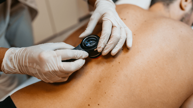 What to Expect From Your First Skin Check