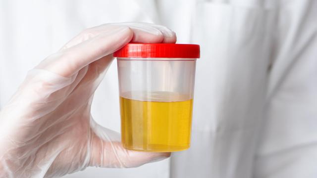 Scientists Have Figured Out Why Pee Is Yellow