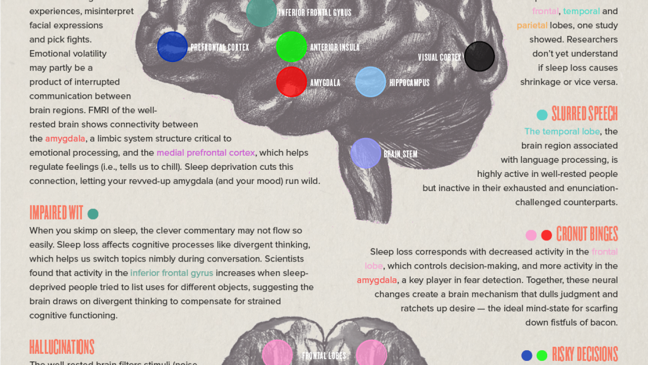 This Graphic Explains How Lack Of Sleep Can Negatively Affect Your Brain