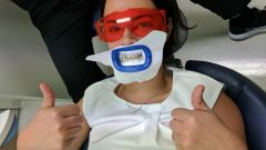 Road Test: Philips Zoom WhiteSpeed Teeth Whitening