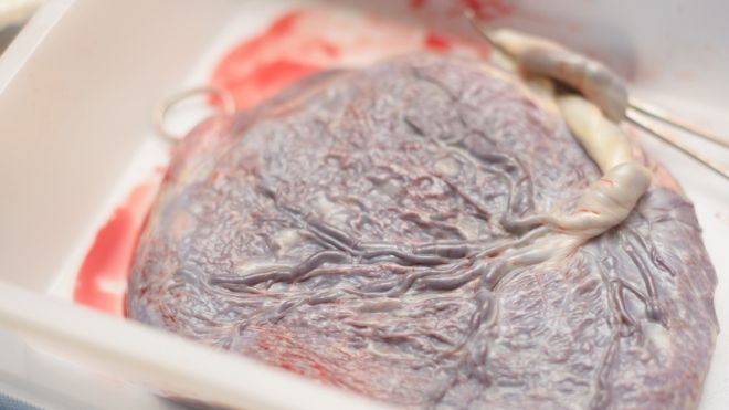 Why You Shouldn’t Eat Your Placenta