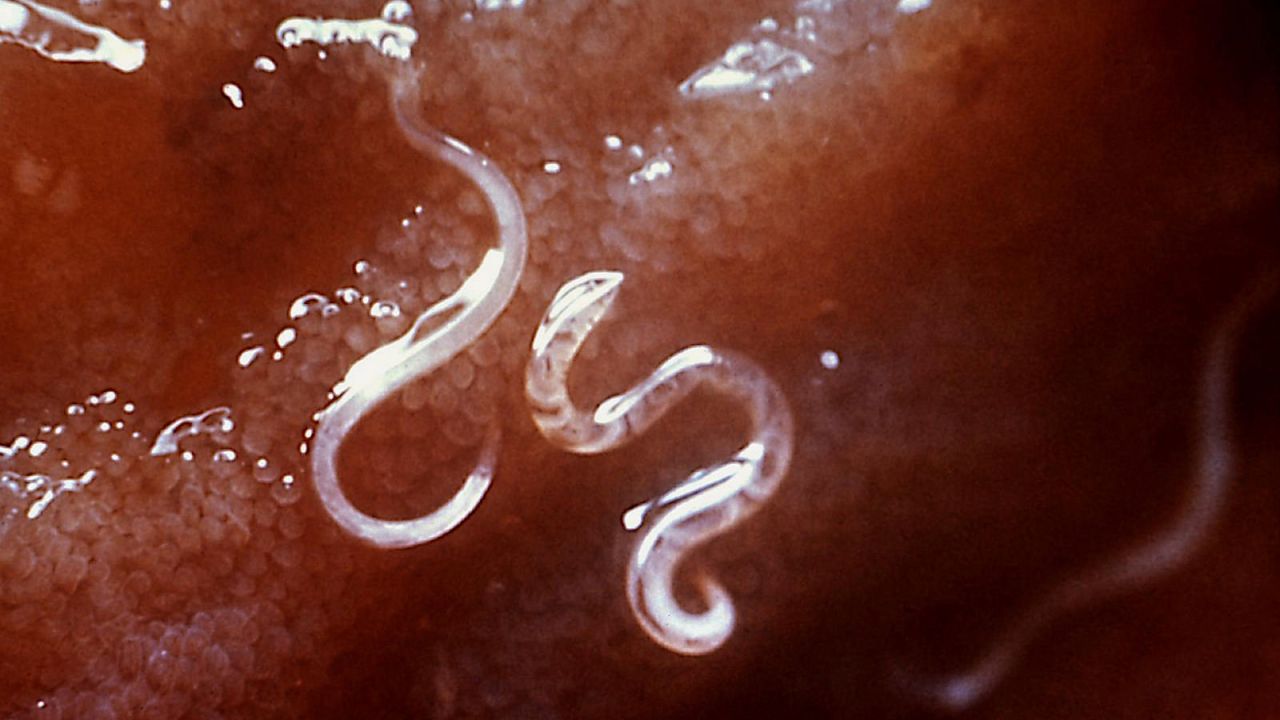 How To Prevent Getting Hookworms On Your Next Beach Holiday