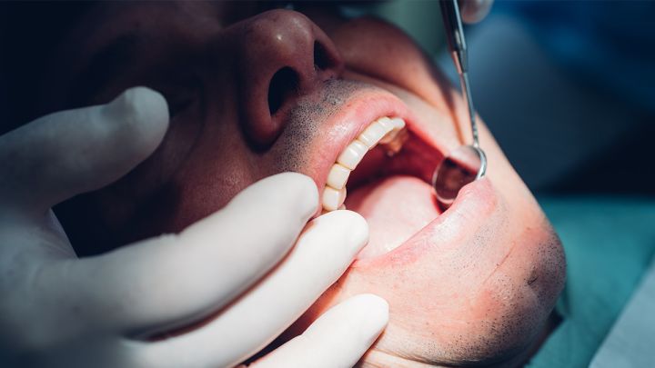 Skipped Your Dentist Appointment? Here’s How To Avoid Post-Lockdown Tooth Pain