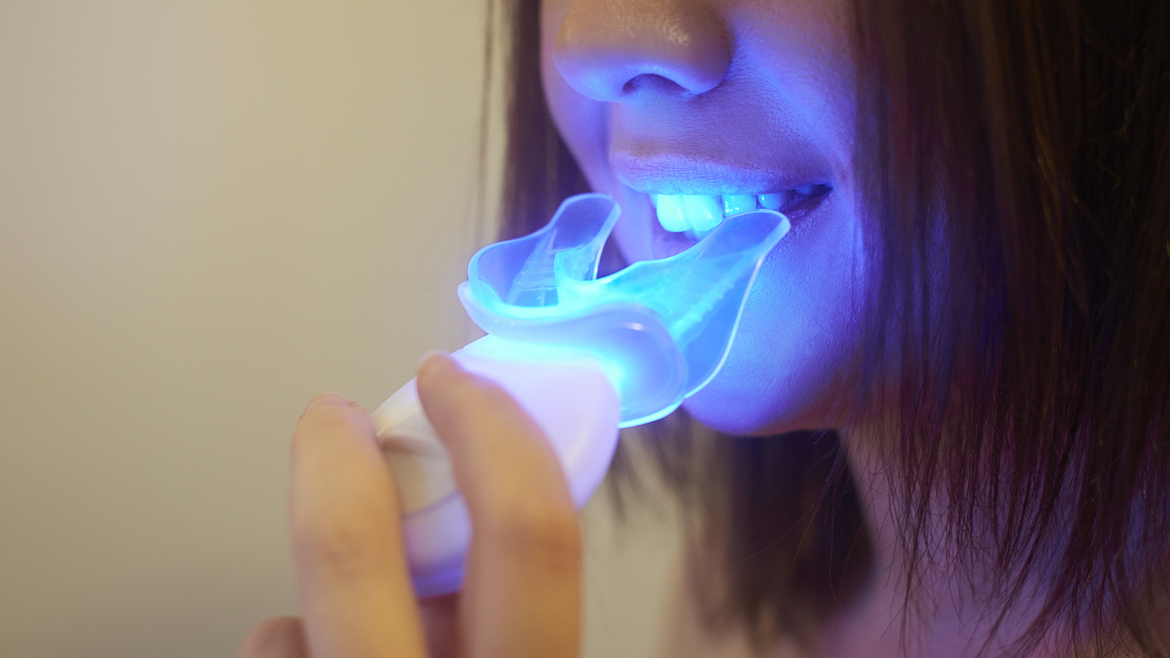 Put the Sparkle Back in Your Smile With These 5 Highly-Rated Teeth Whitening Kits